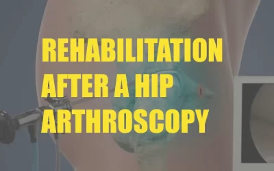 Rehabilitation after Hip Arthroscopy