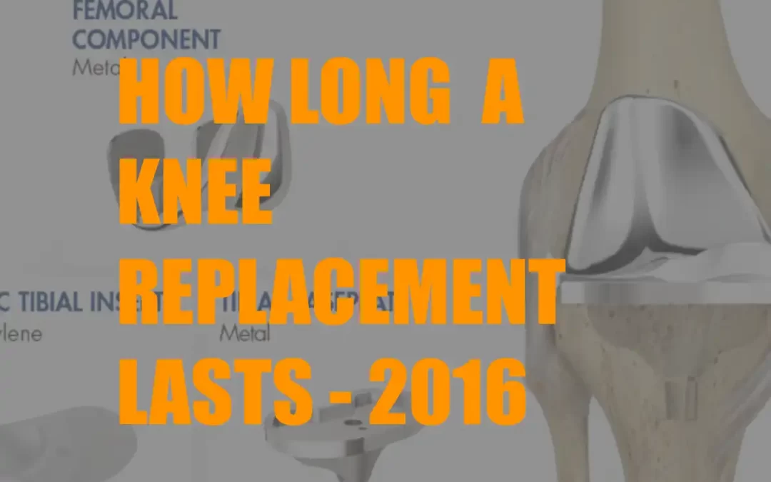 How long a Total Knee Replacement Lasts