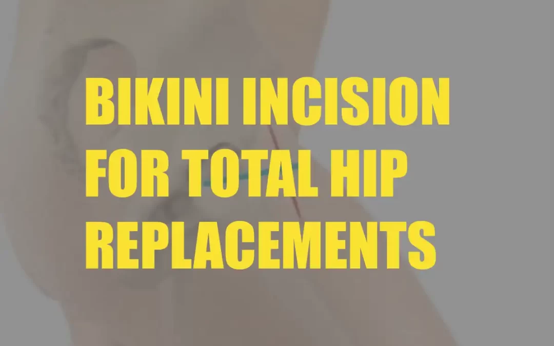 The Bikini incision for Total Hip Replacements